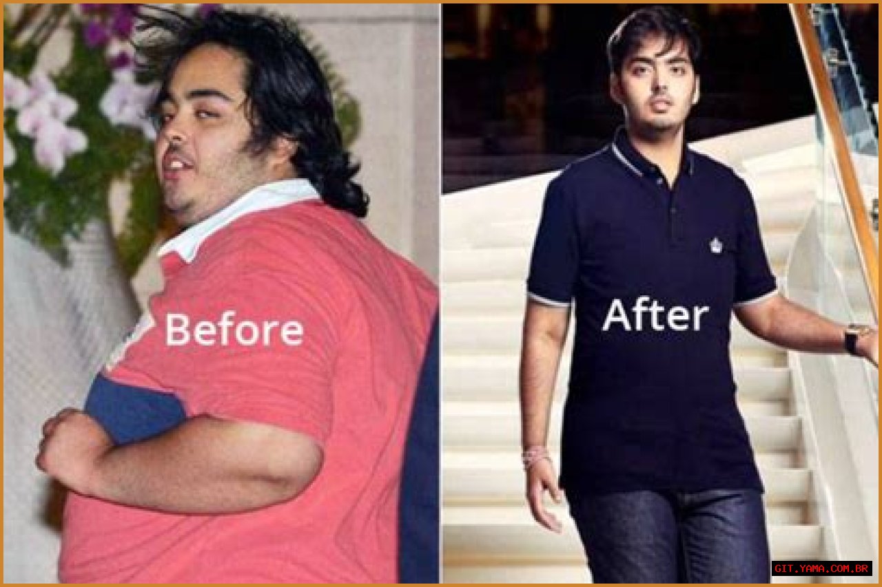 Anant Ambani: A Journey Through Mental Health And Resilience