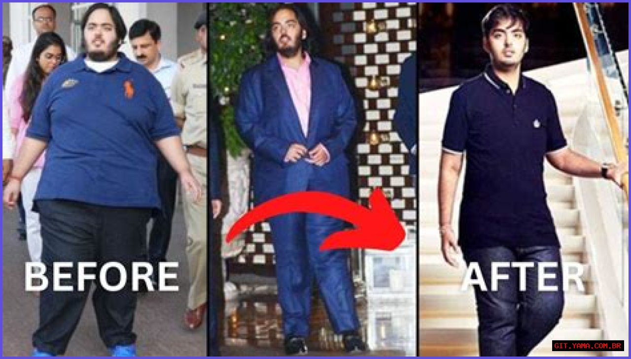 Anant Ambani's Health Journey: Understanding His Illness