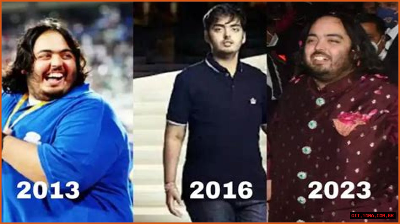 Anant Mukesh Ambani's Health Challenges: An Insightful Overview