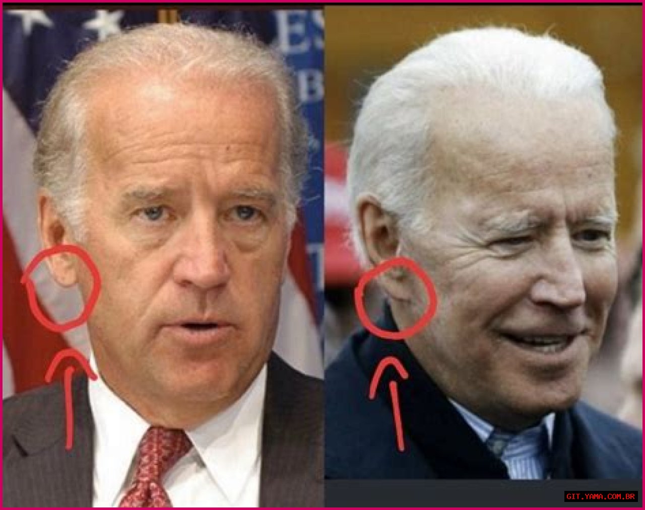 Unveiling The Secrets Of Joe Biden's Ears: Discoveries And Insights